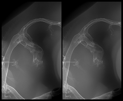 stage 28 chick embryo x-ray