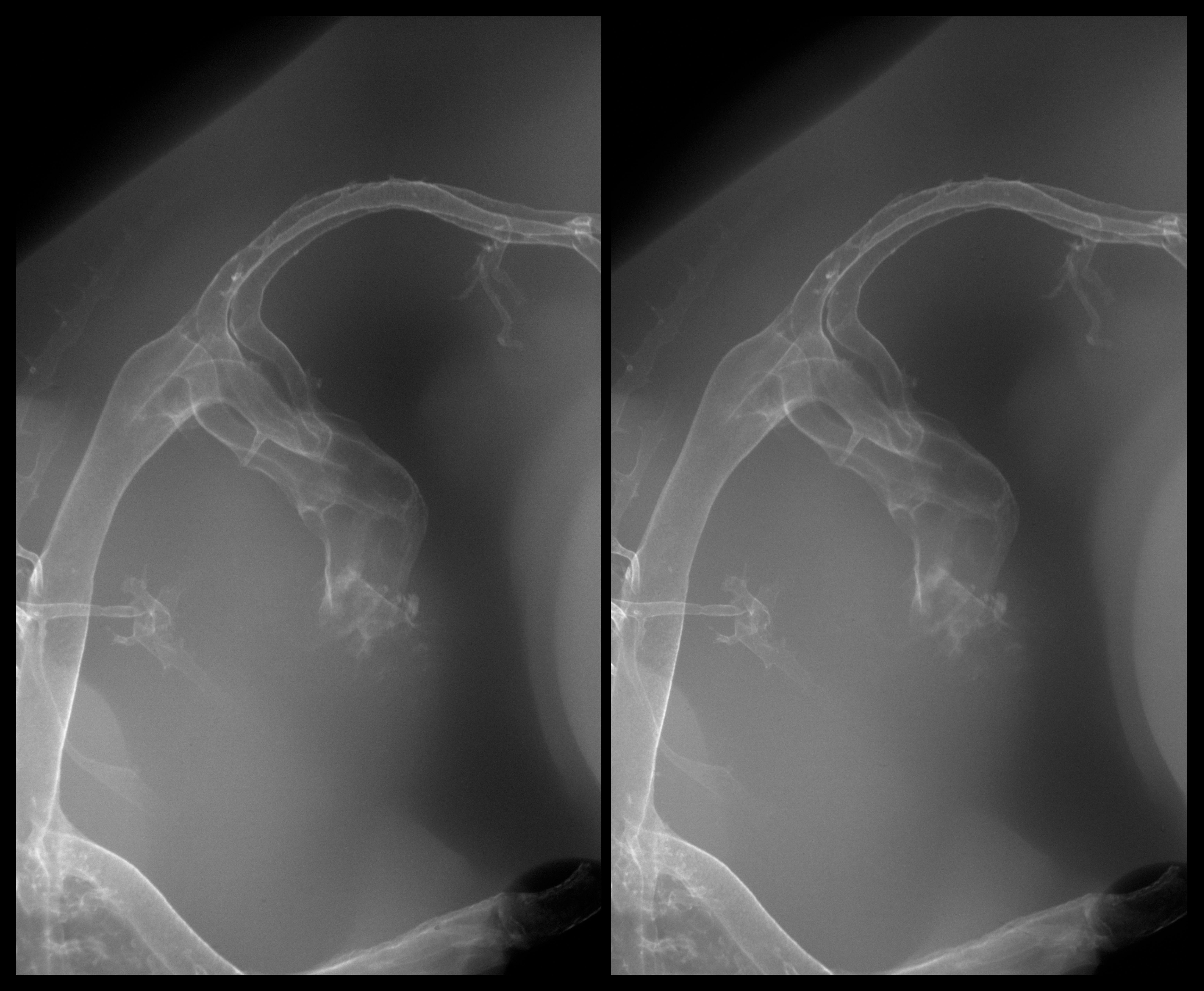 stage 28 chick embryo x-ray