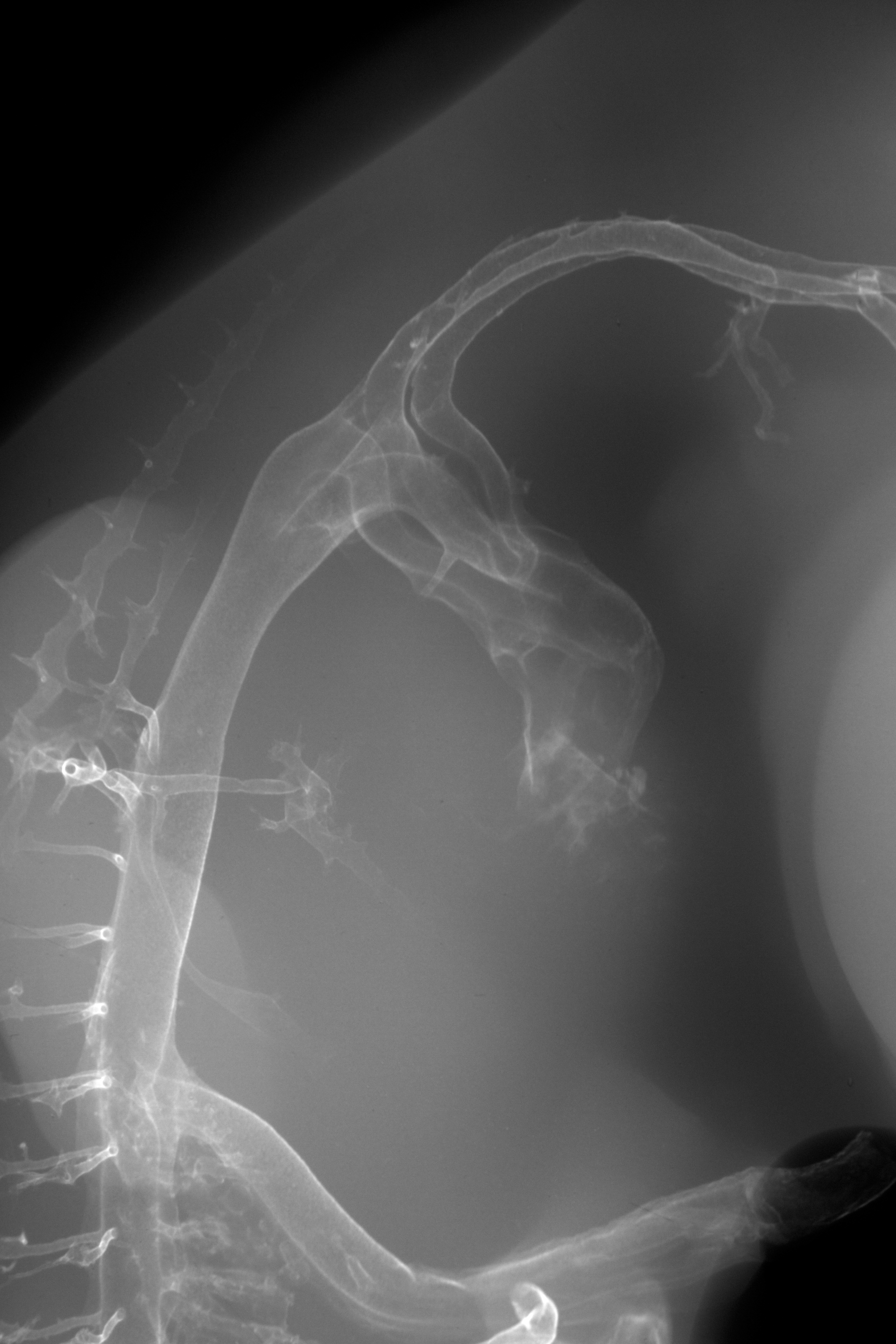 stage 28 chick embryo x-ray