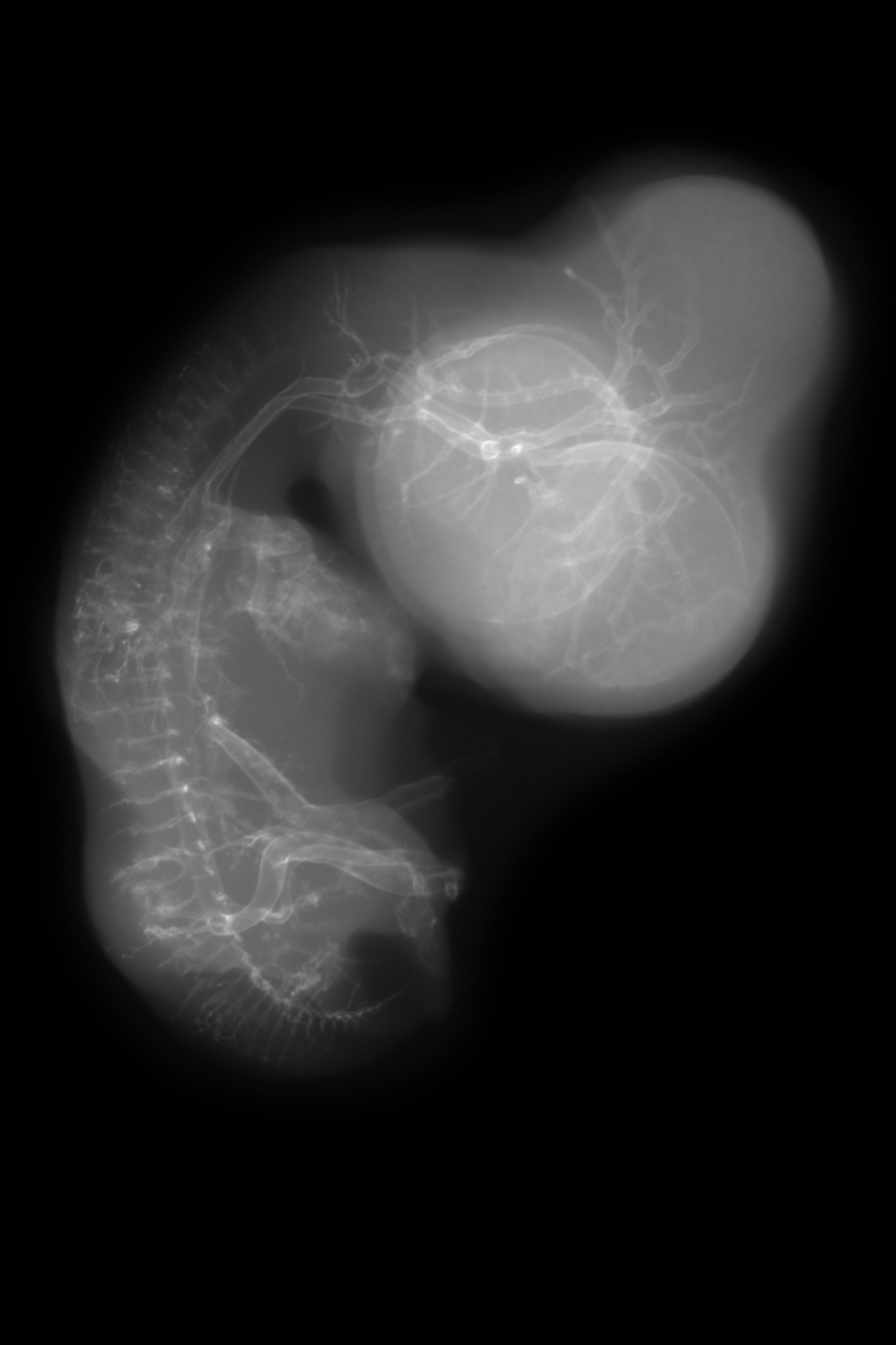 stage 29 chick embryo x-ray