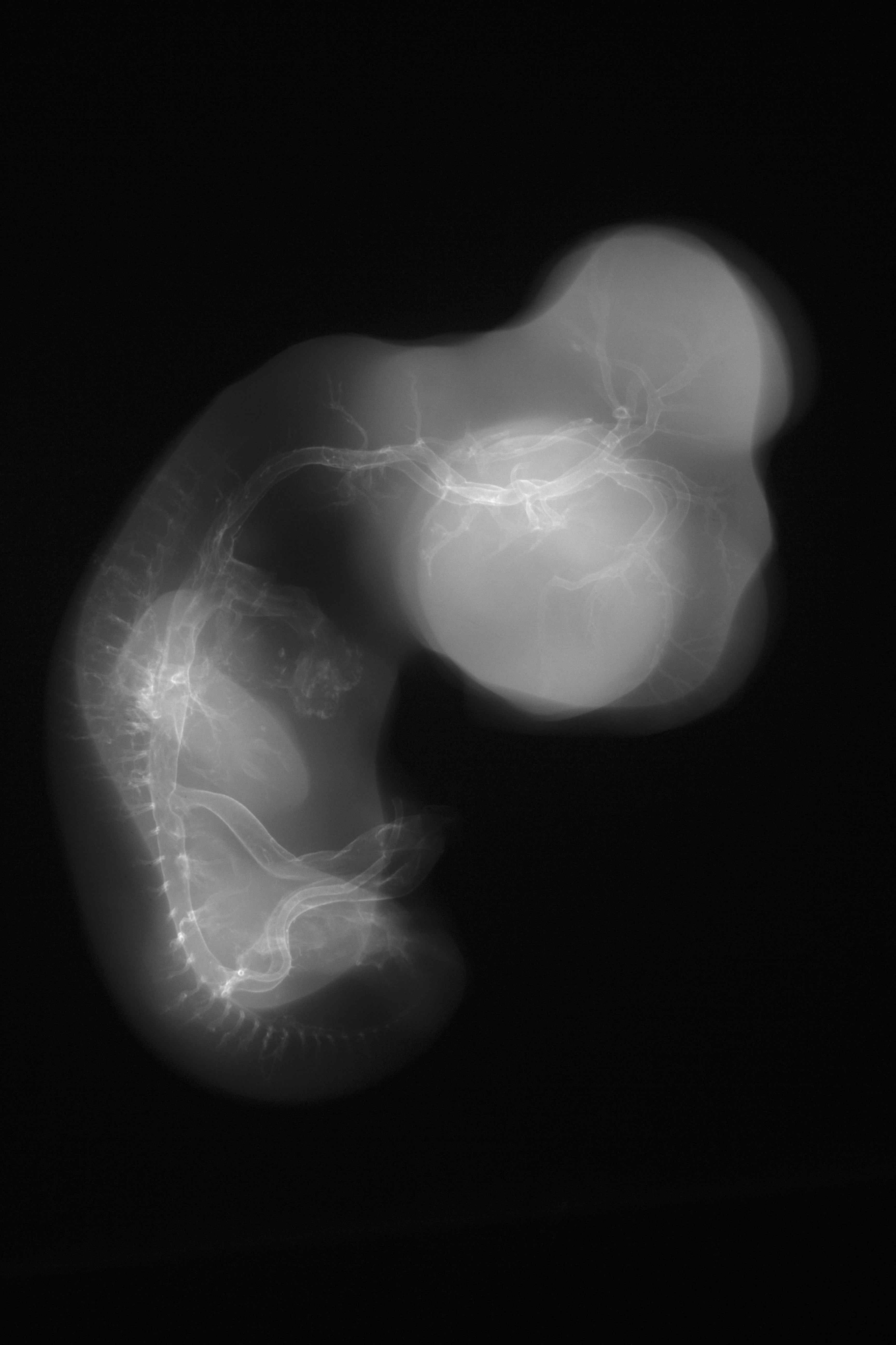 stage 29 chick embryo x-ray