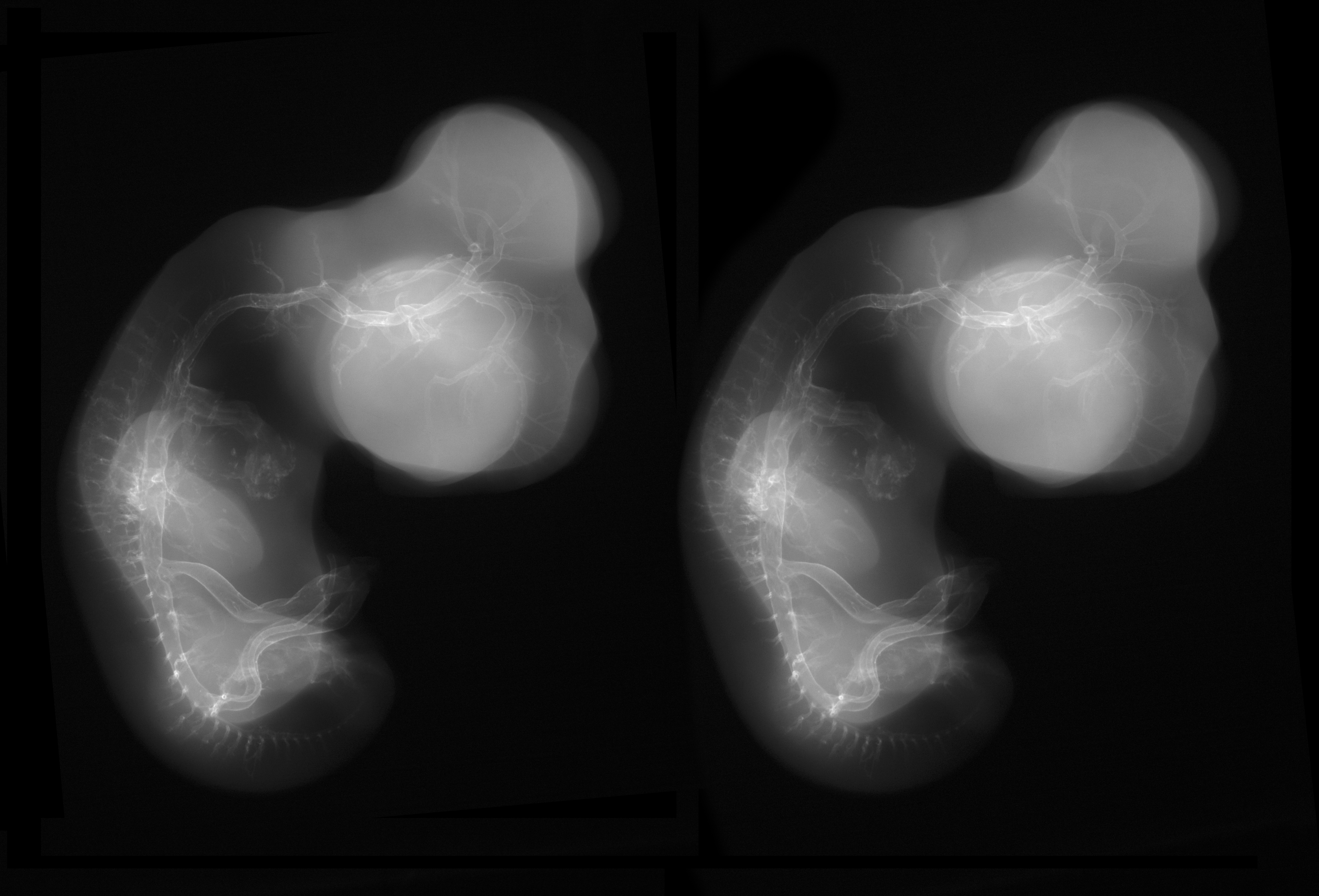 stage 29 chick embryo x-ray