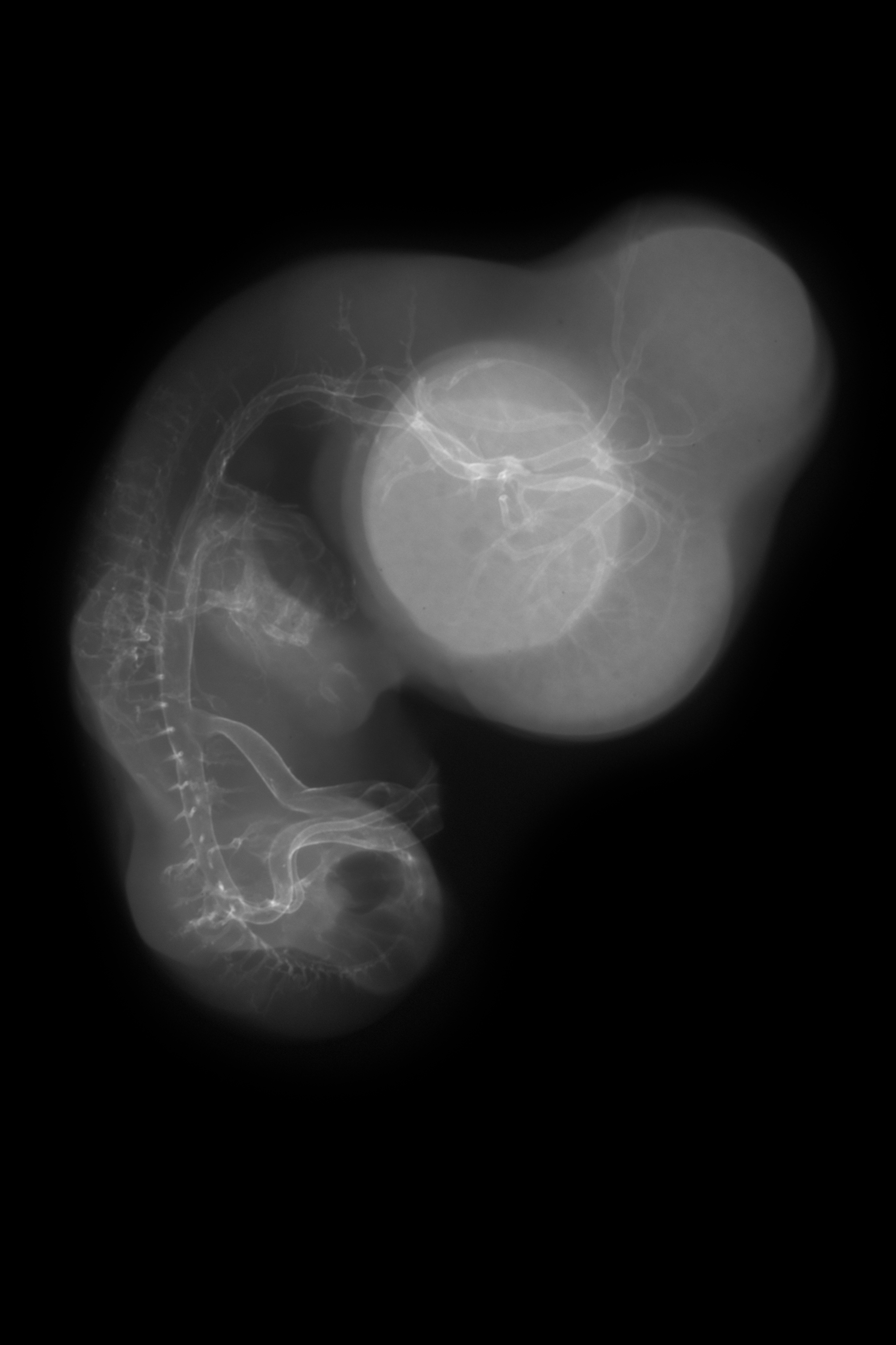 stage 29 chick embryo x-ray