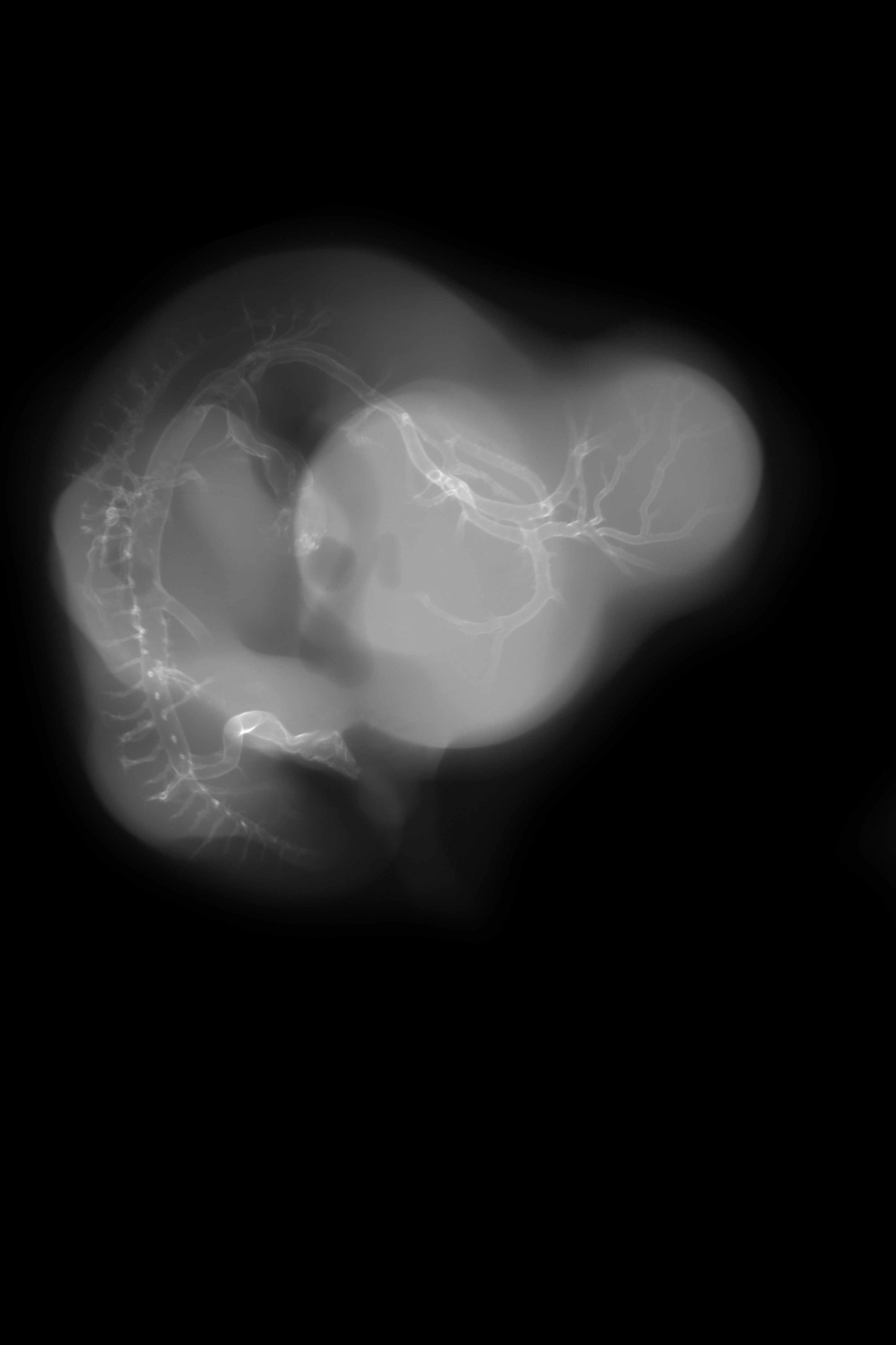 stage 29 chick embryo x-ray