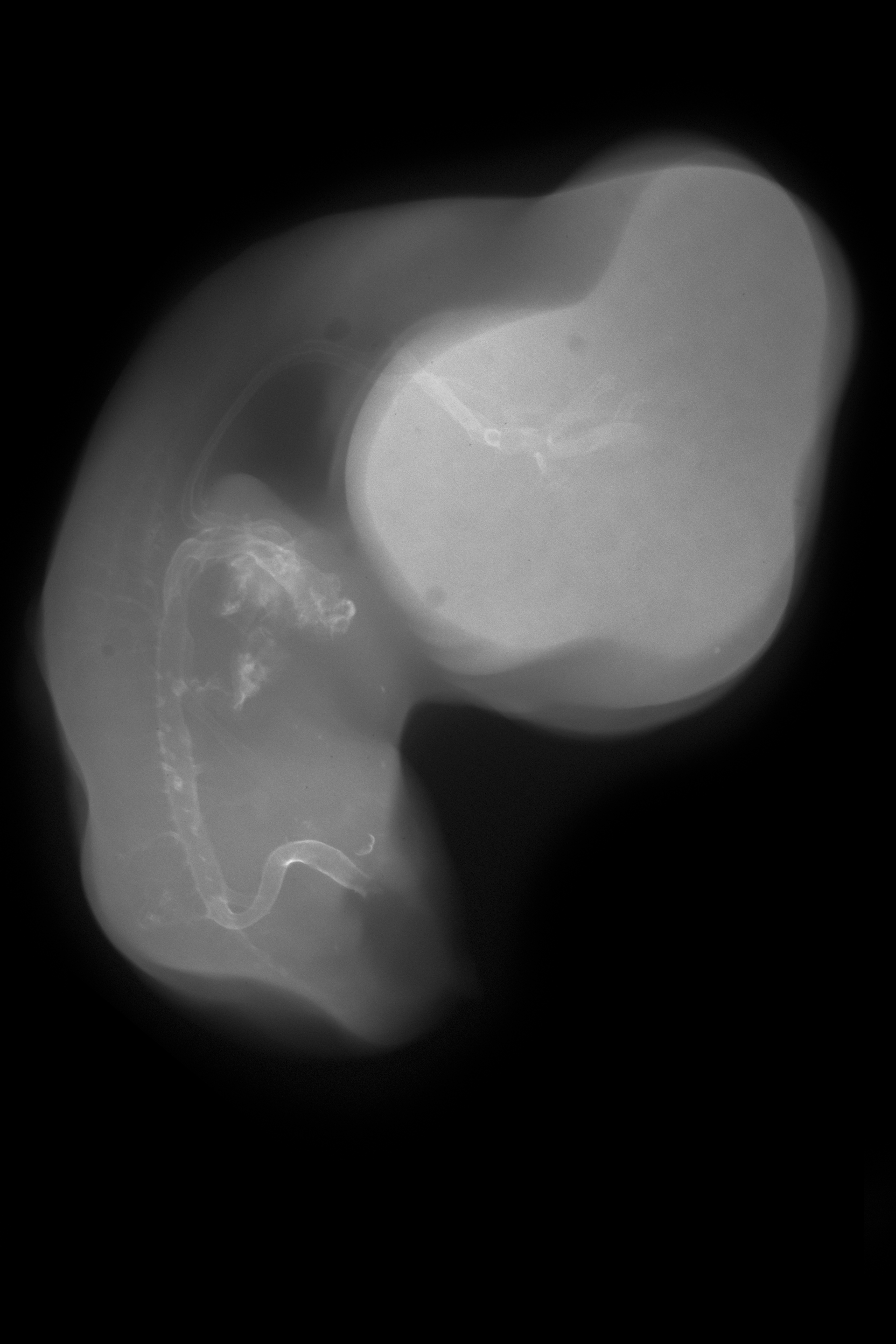 stage 29 chick embryo x-ray