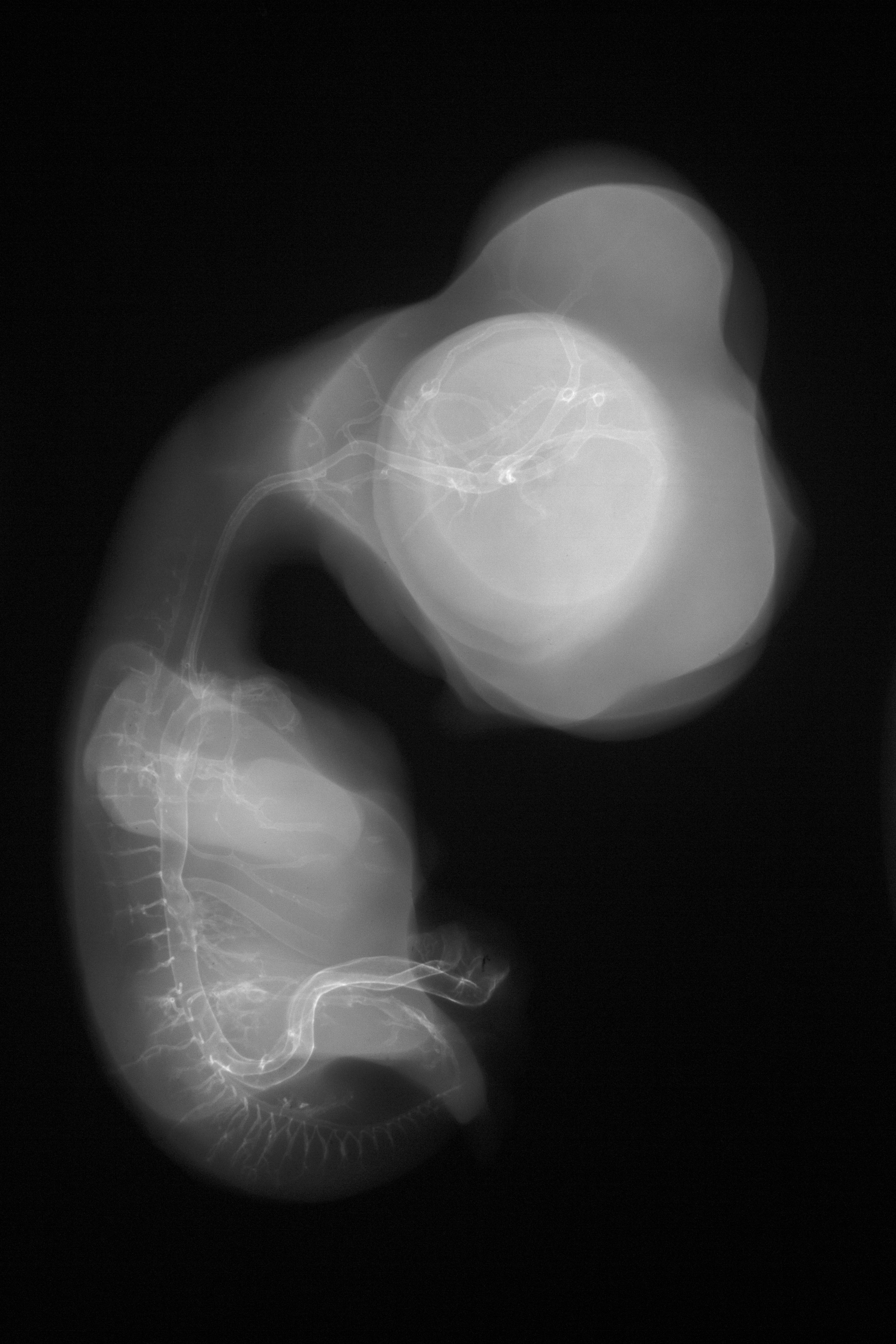 stage 30 chick embryo x-ray