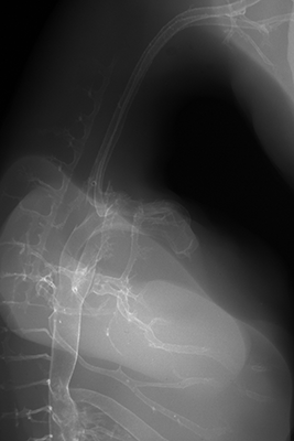 stage 30 chick embryo x-ray