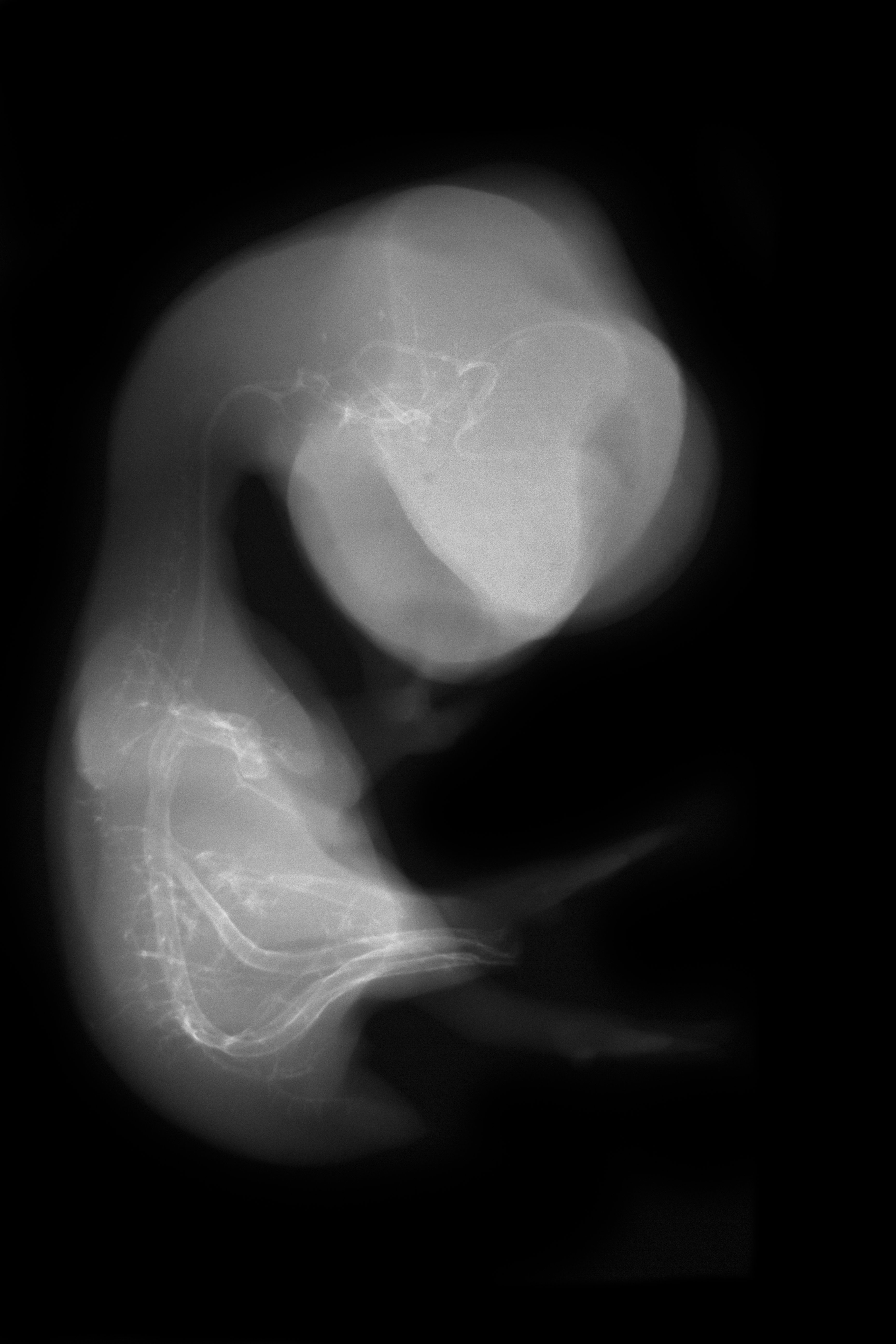stage 35 chick embryo x-ray