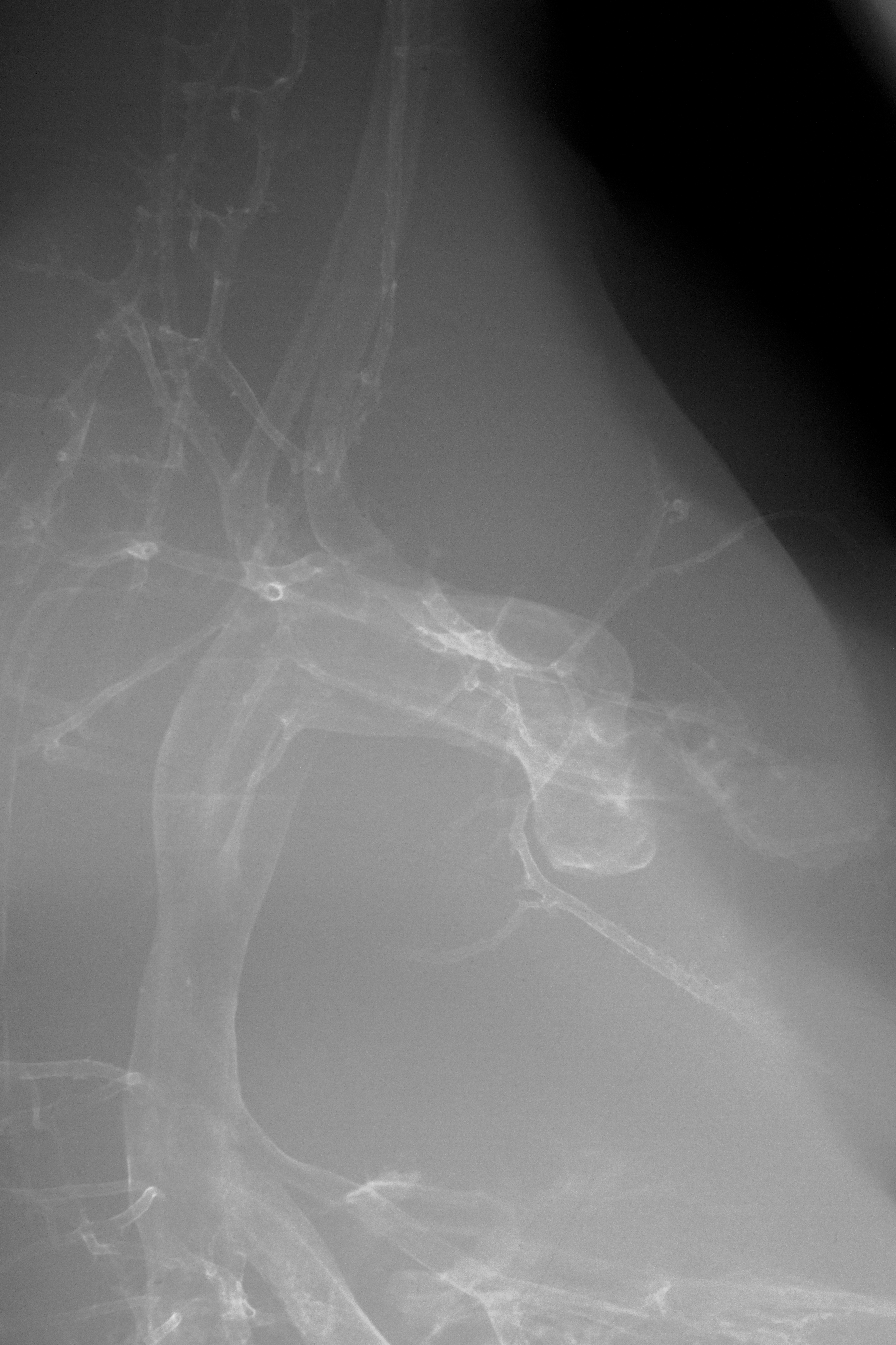 stage 35 chick embryo x-ray