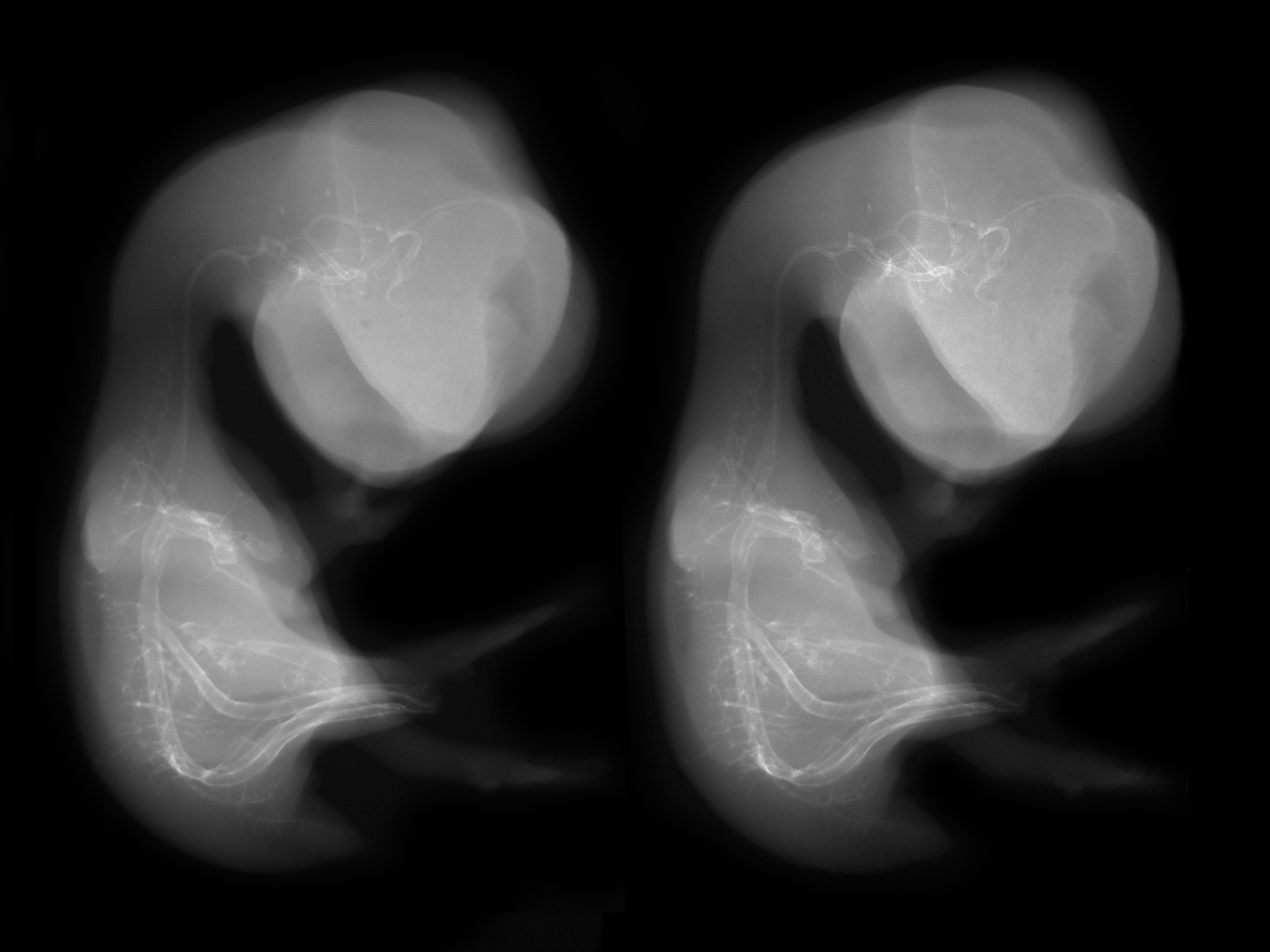 stage 35 chick embryo x-ray