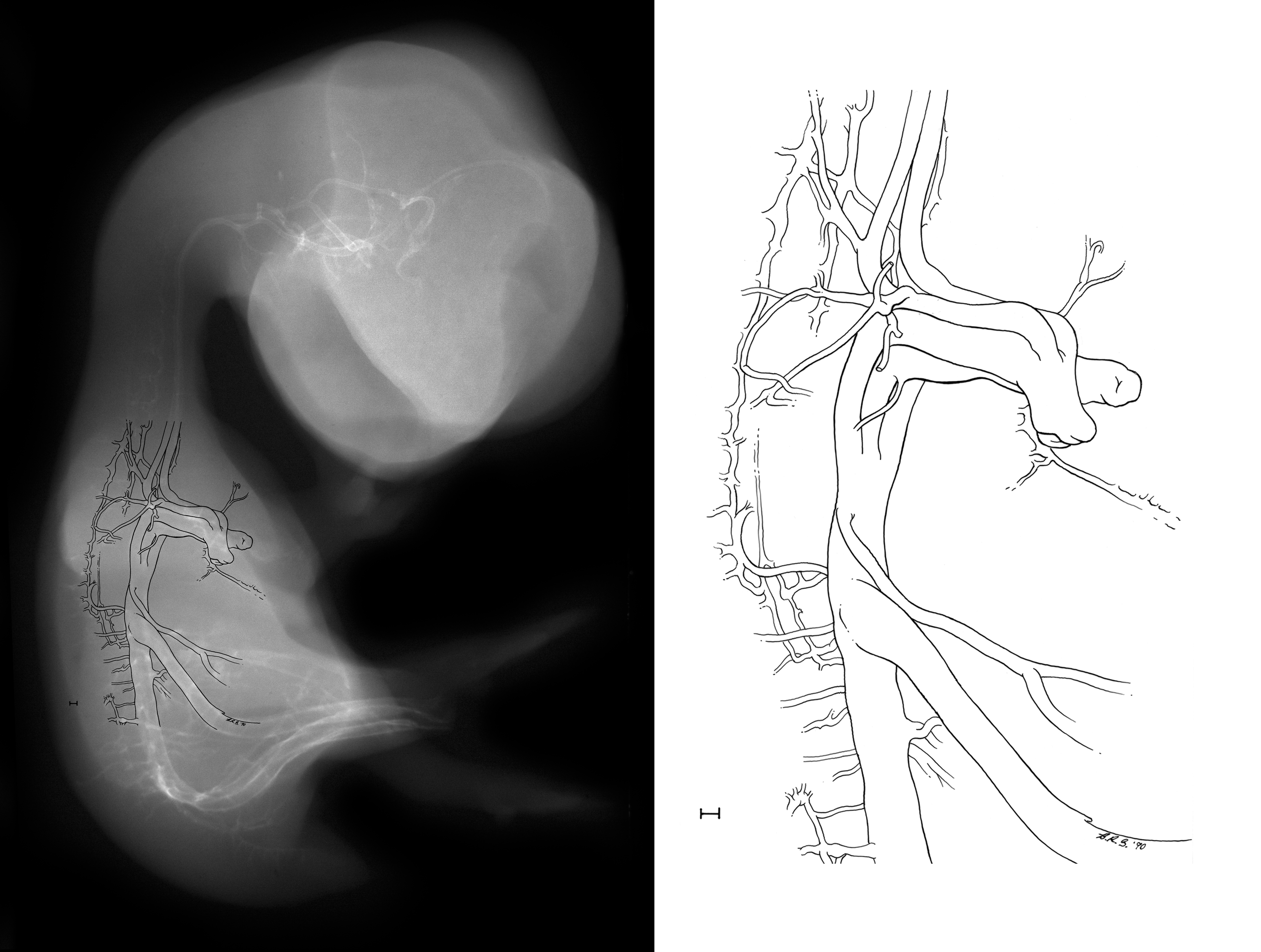 stage 35 chick embryo x-ray