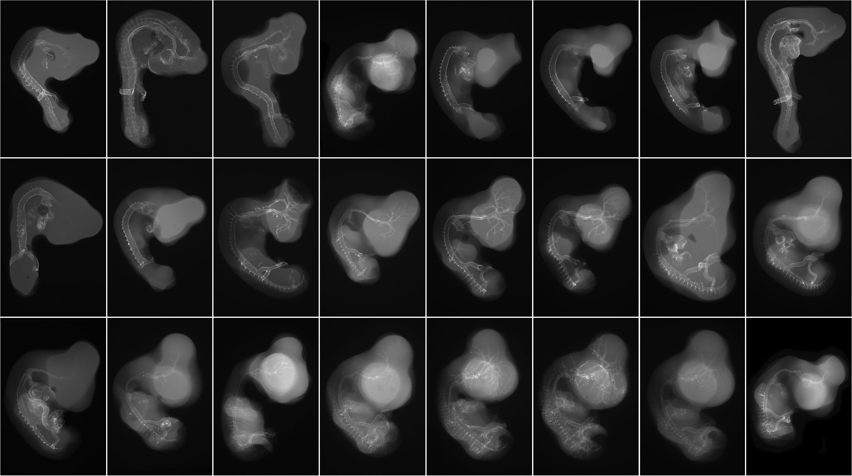 Composite Image of numerous chick embryo x-ray micrographs