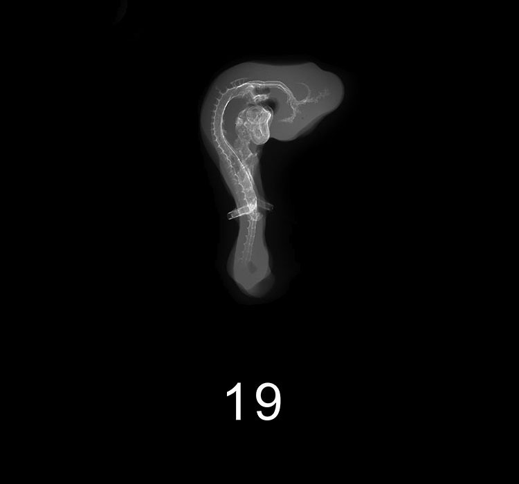 Stage 19 Embryo Image