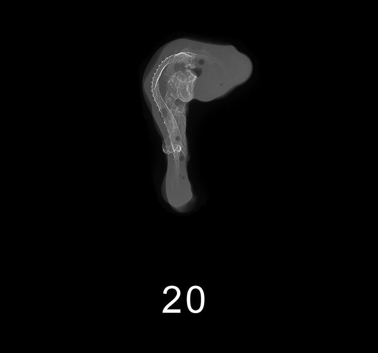 Stage 20 Embryo Image