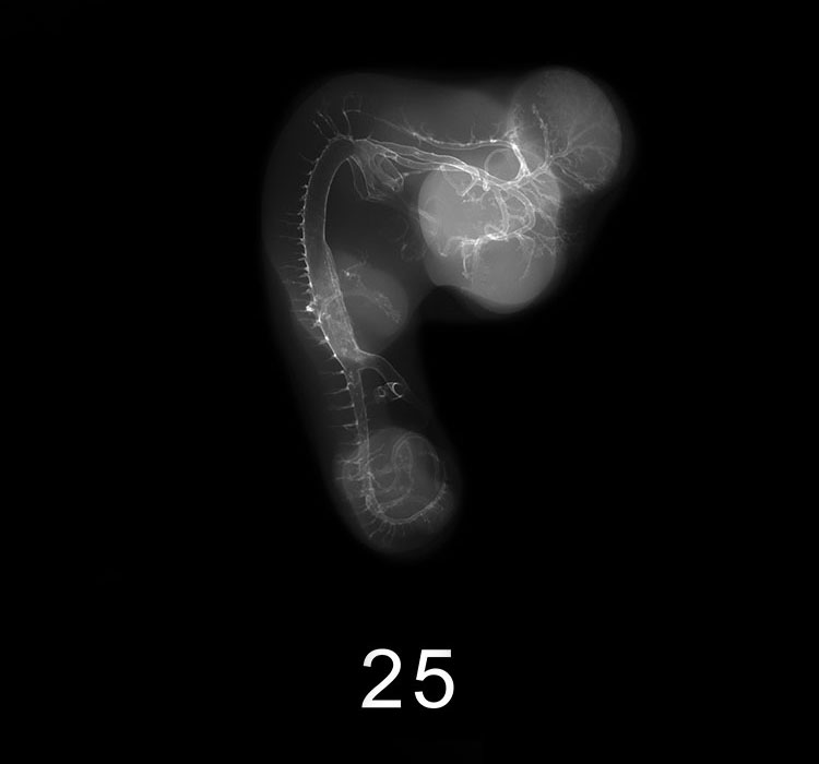 Stage 22 Embryo Image