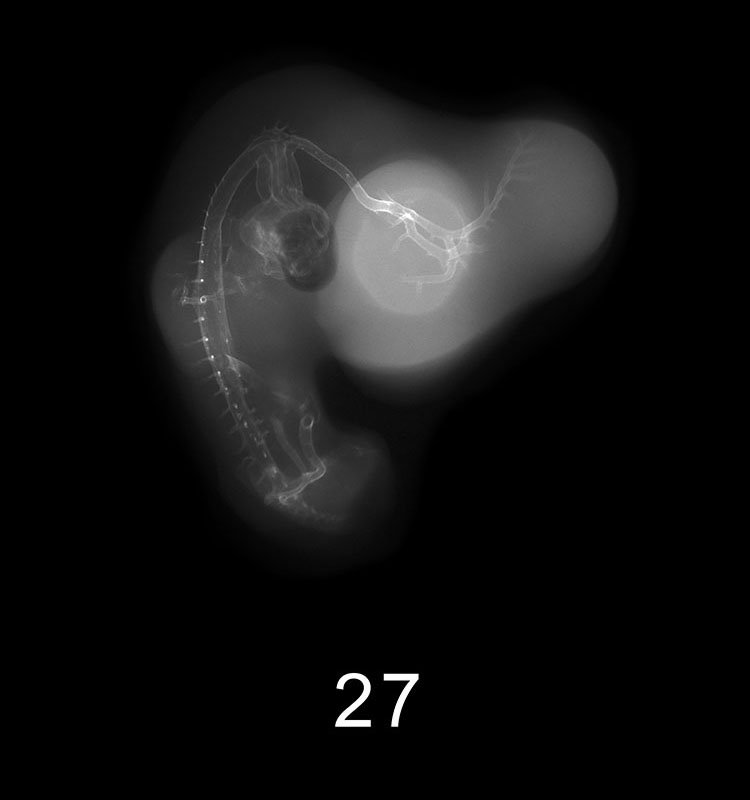 Stage 13 Embryo Image