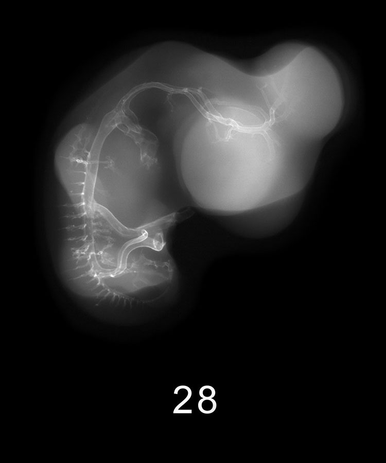 Stage 13 Embryo Image