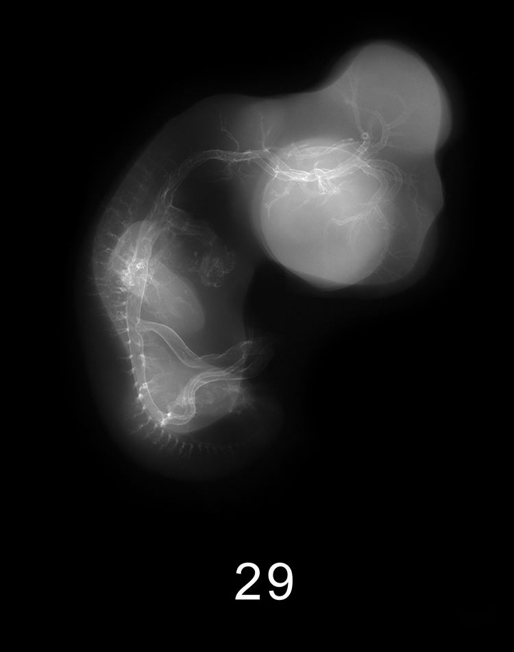 Stage 13 Embryo Image