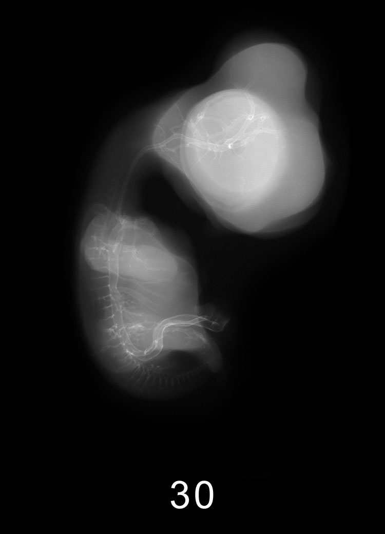 Stage 13 Embryo Image