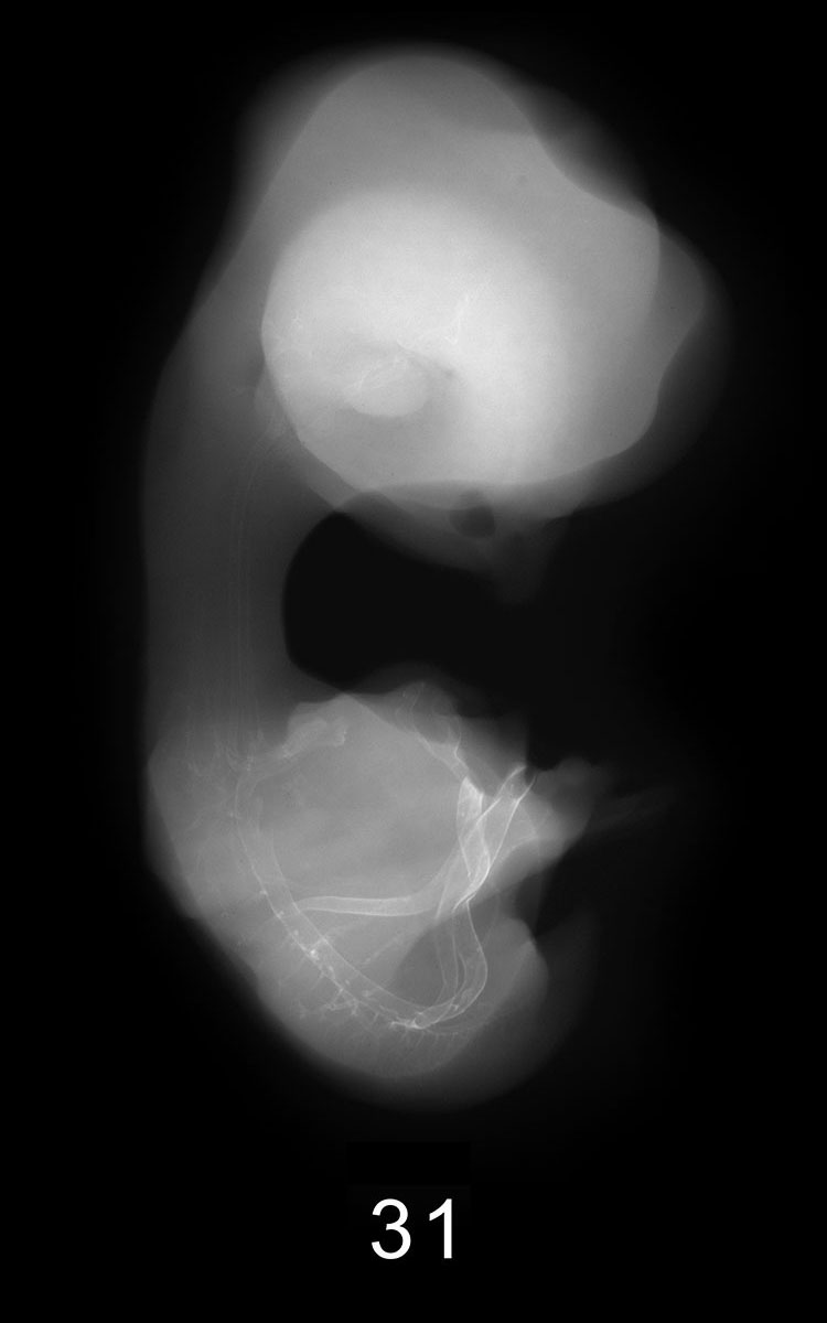 Stage 13 Embryo Image