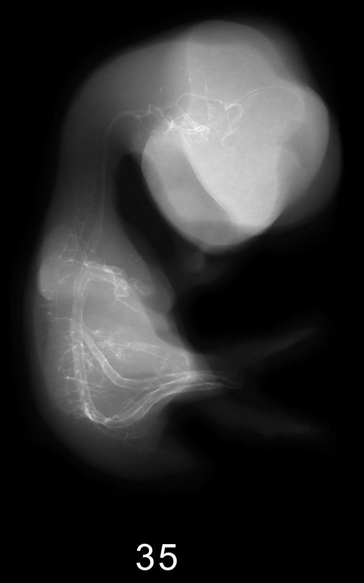 Stage 13 Embryo Image